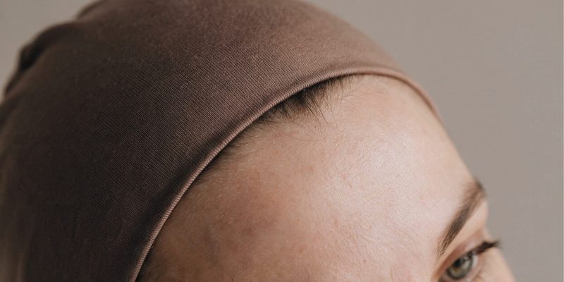 Hijab and Hair Loss